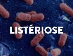 listériose